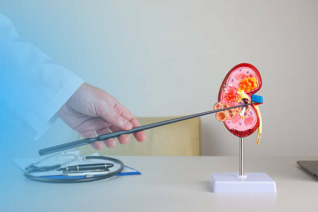Best Laser Endoscopic Kidney Stone Treatment In Vashi